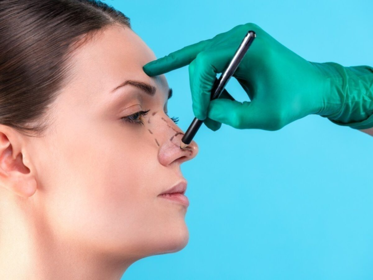 Natural Results: Rhinoplasty in Islamabad for You Today